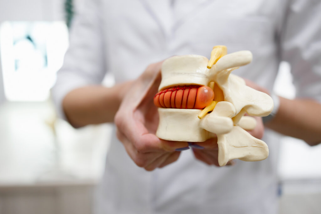 Lumbar Spinal Stenosis: Why Walking and Standing Can Cause Back and Leg Pain