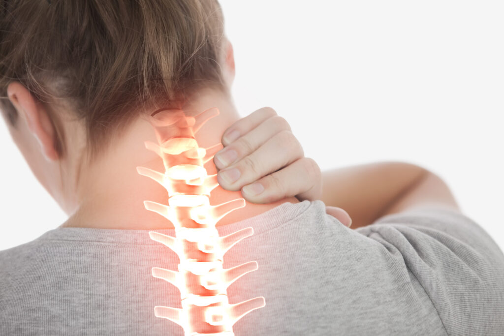 Cervical Radiculopathy: When a Problem in Your Neck Causes Pain, Tingling, or Weakness in Your Arm